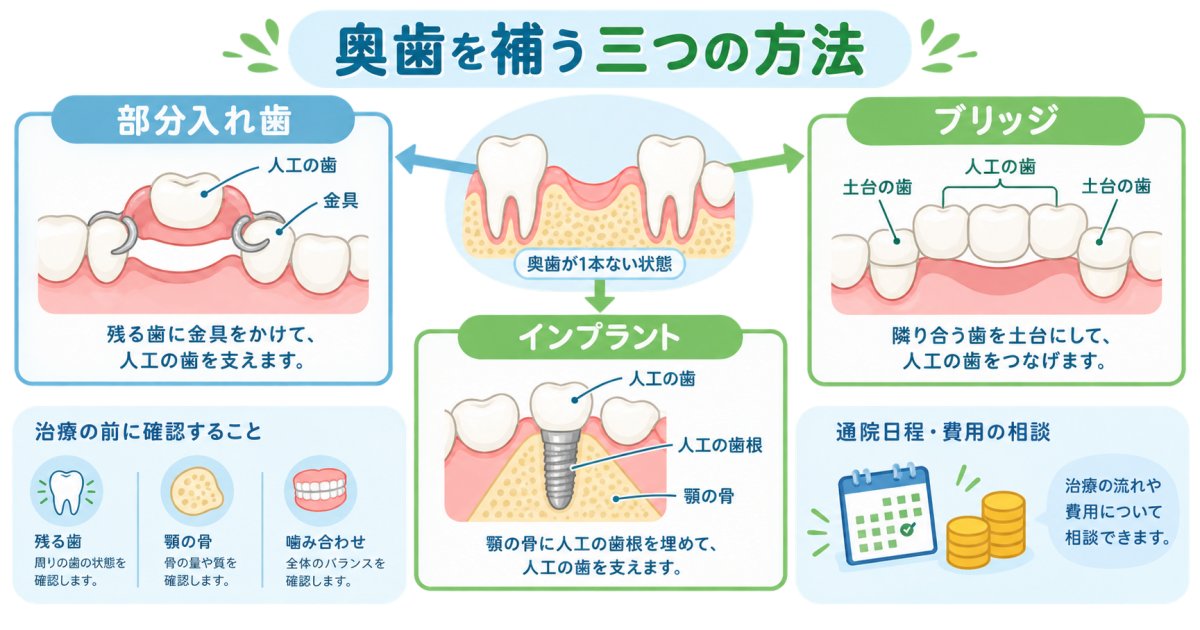 奥歯を失い仕事や食事が心配な方へ｜入れ歯・ブリッジ・インプラント