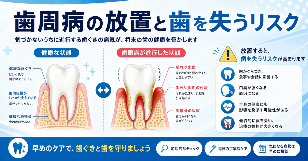 歯周病を放置するとどうなる？歯を失う前に知っておきたいリスク